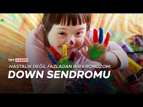 Hastalık değil fazladan bir kromozom: Down sendromu