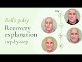 Bell's palsy recovery: Step-by-step explanation