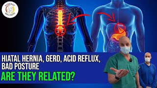 Hiatal Hernia, GERD, ACID REFLUX and BAD POSTURE, Are They Related