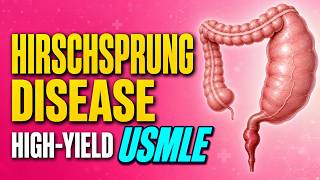 👀 What They Actually Test: Hirschsprung Disease | Medical School USMLE High Yield Review