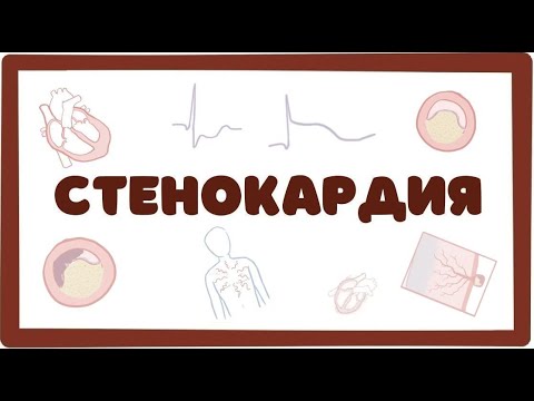 Video: Lacunar Stenokardija - Simptomi Pieaugušajiem, ārstēšana