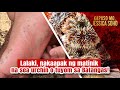 Lalaki, nakaapak ng matinik na sea urchin o tuyom sa Batangas! | Kapuso Mo, Jessica Soho