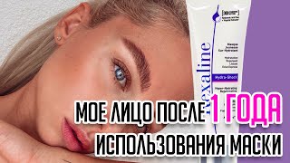 Маска для лица, которая изменила мою жизнь!Год использования маски Rexaline. Честный обзор. - Видео от FialcaPeg