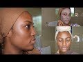 SKIN CARE ROUTINE FOR OILY AND SENSITIVE SKIN|| AVOIDING ACNE