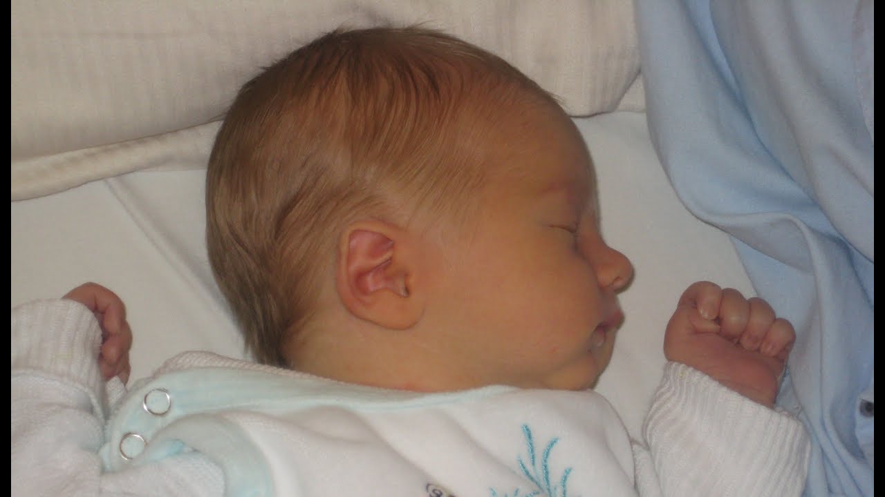 Держать голову набок. Долихоцефалическая форма головы у ребенка. Кривошея у новорожденного 2 месяца. Форма головы новорожденного в 1 месяц.