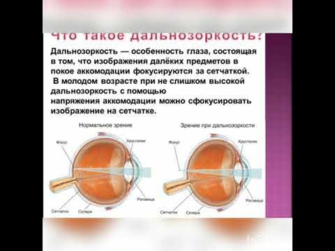 Оптическая система глаза дефекты зрения проект