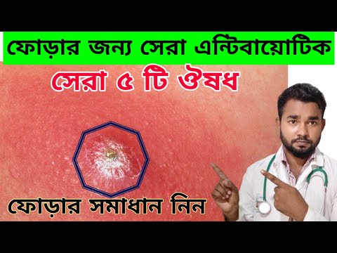 ভিডিও: ফোস্কা পোড়ার 3 টি উপায়