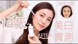 OLAY X CC|✨14日實測美白精華！成功退到痘印嗎？✨297皮膚 ... 