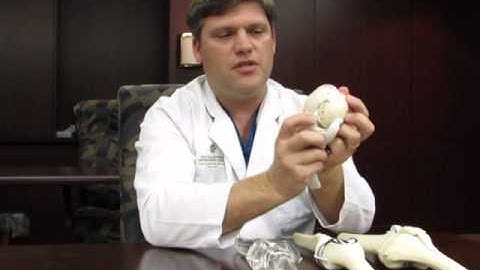 What is Knee Resurfacing - Dr. Richard Ursone
