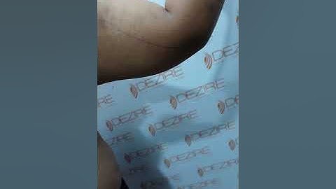 ARM & 360° Abdomen Liposuction Planning #shorts