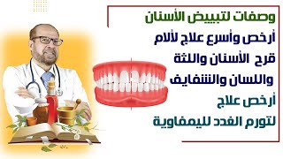 وصفات لتبييض الأسنان أرخص وأسرع علاج لألاموقرح الأسنان واللثة واللسان والشفايف