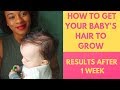 How To Make Baby Hair Grow