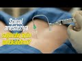 Spinal anesteziya sağlamlıq üçün təhlükəlidirmi? - Uzman cərrah mama-ginekoloq Aytən Nəcəfəliyeva