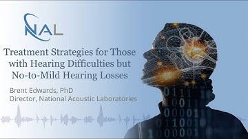 Soundbites S03E01: To fit or not to fit! Strategies for fitting no-to-mild hearing losses