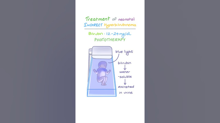 Treatment of Neonatal Indirect Hyperbilirubinemia