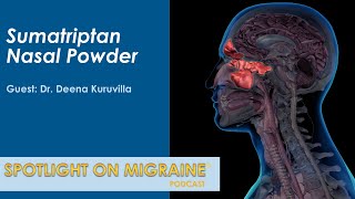 Sumatriptan Nasal Powder for the Acute Treatment of Migraine - Spotlight on Migraine S4:Ep12