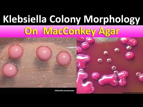 Klebsiella Colony Morpholohy on MacConkey agar