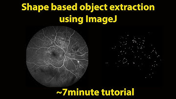 Shape Based Object Extraction in ImageJ or Fiji