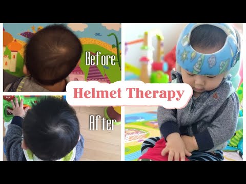 Video: Paano Maghilom Ng Isang Baby Hat-helmet