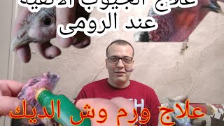 اسهل طريقة لعلاج ورم وش الديك الرومي والجيوب الأنفية بكل سهوله