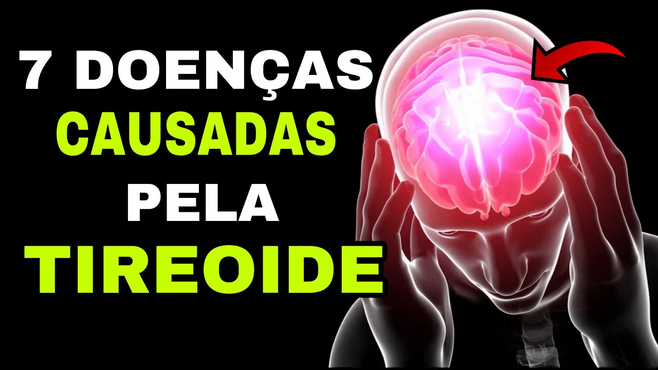 7 DOENÇAS CAUSADAS PELA TIREOIDE (Hipotireoidismo e Hipertireoidismo)