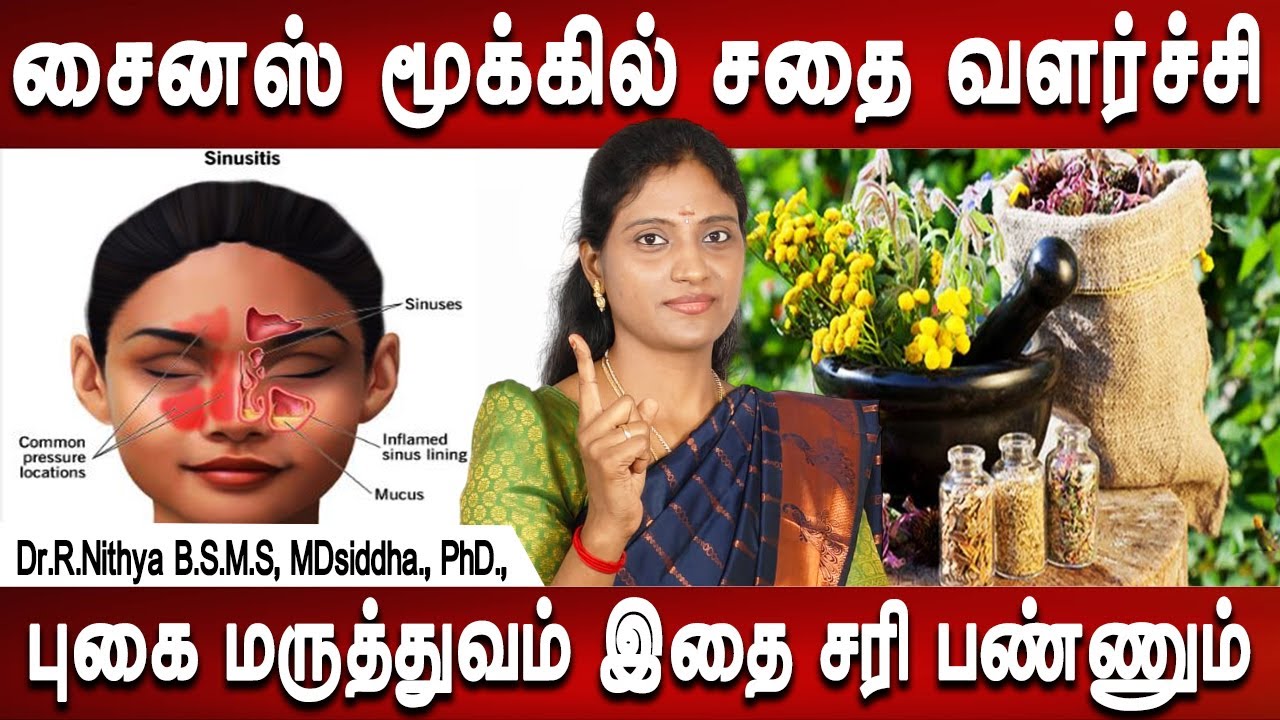 இதற்கு அறுவை சிகிச்சை தேவையில்லை | Sinusitis symptoms & treatment | Dr.Nithya | Mrladies