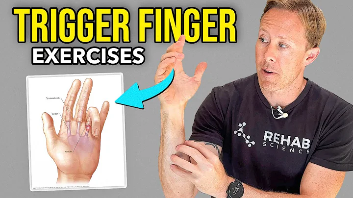 5 Trigger Finger Rehab Exercises