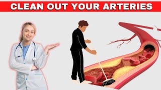 The Best FOODS to Clean Out Your Arteries