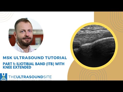 Part 1: Find that ITB! How to find the Iliotibial band (ITB) at the knee on ultrasound
