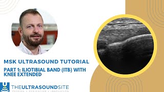 Part 1: Find that ITB! How to find the Iliotibial band (ITB) at the knee on ultrasound screenshot 2