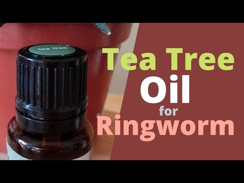 Tea Tree Oil for Ringworm - Does it Help ? - Very Effective!