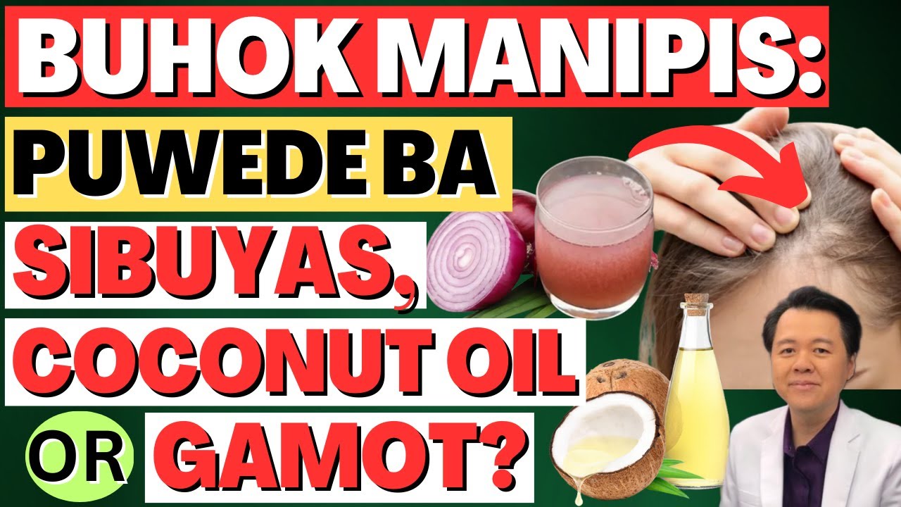 Buhok Manipis: Puwede ba Sibuyas, Coconut oil or Gamot? - By Doc Willie Ong