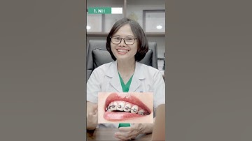 Niềng răng mắc cài có mấy loại #shorts #xuhuong #niengrang