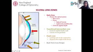 Scleral Lens Assessment and Fitting