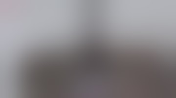 Implants hydrophilicity    Noris Medical