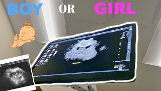 HOME WATER BIRTH | FINDING OUT THE GENDER