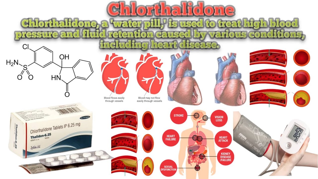 Chlorthalidone||Chlorthalidone Uses||How Chlorthalidone works||Common side effects of Chlorthalidone