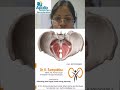 what are pelvicfloor muscles ❓️❓️ #femaleurologist #live #urinarytractinfections #doctor #apollo