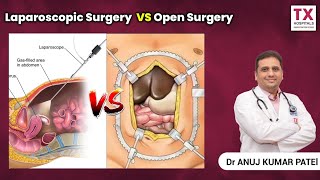 Difference Between Laparoscopic Surgery and Open surgery || Dr Anuj Kumar || TX Hospitals
