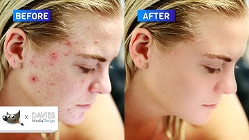 5 Step Next-Level Skin Retouching in GIMP