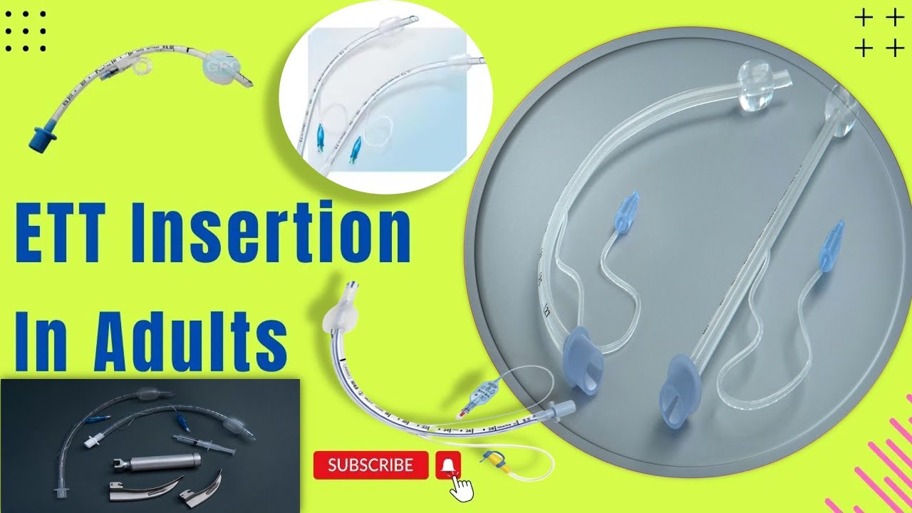 Endotracheal Intubation Endotracheal Intubation in Adults ETT