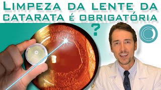 A limpeza da lente é obrigatória após cirurgia de catarata?