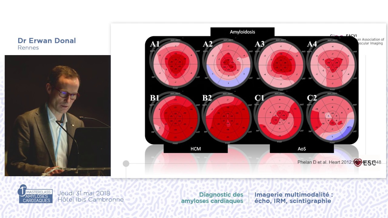 L'_échocardiographie_et_l'amylose._Erwan_Donal_MAC_Amyloidosis