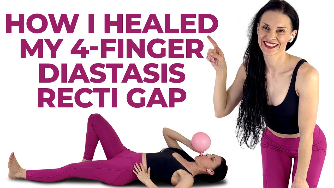 How I Healed My DIASTASIS RECTI (belly bulge)  Diastasis Recti Exercises +  Mistakes! 