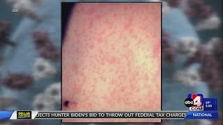 Rising number of measles cases raise concerns for Utah