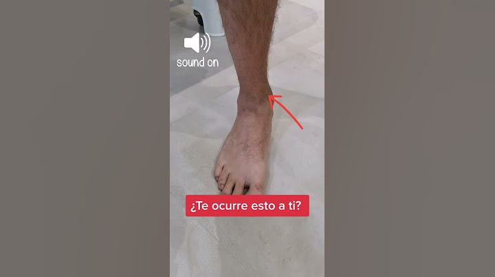 ⚠️¿Por qué CRUJE el Tobillo?🤔 #viral #crack #asmr #ankles #sprainedankle