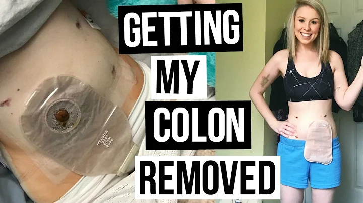 Living with an Ostomy | My Surgery Story + Back to...