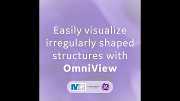 ✨ Easily visualize irregularly shaped structures with OmniView