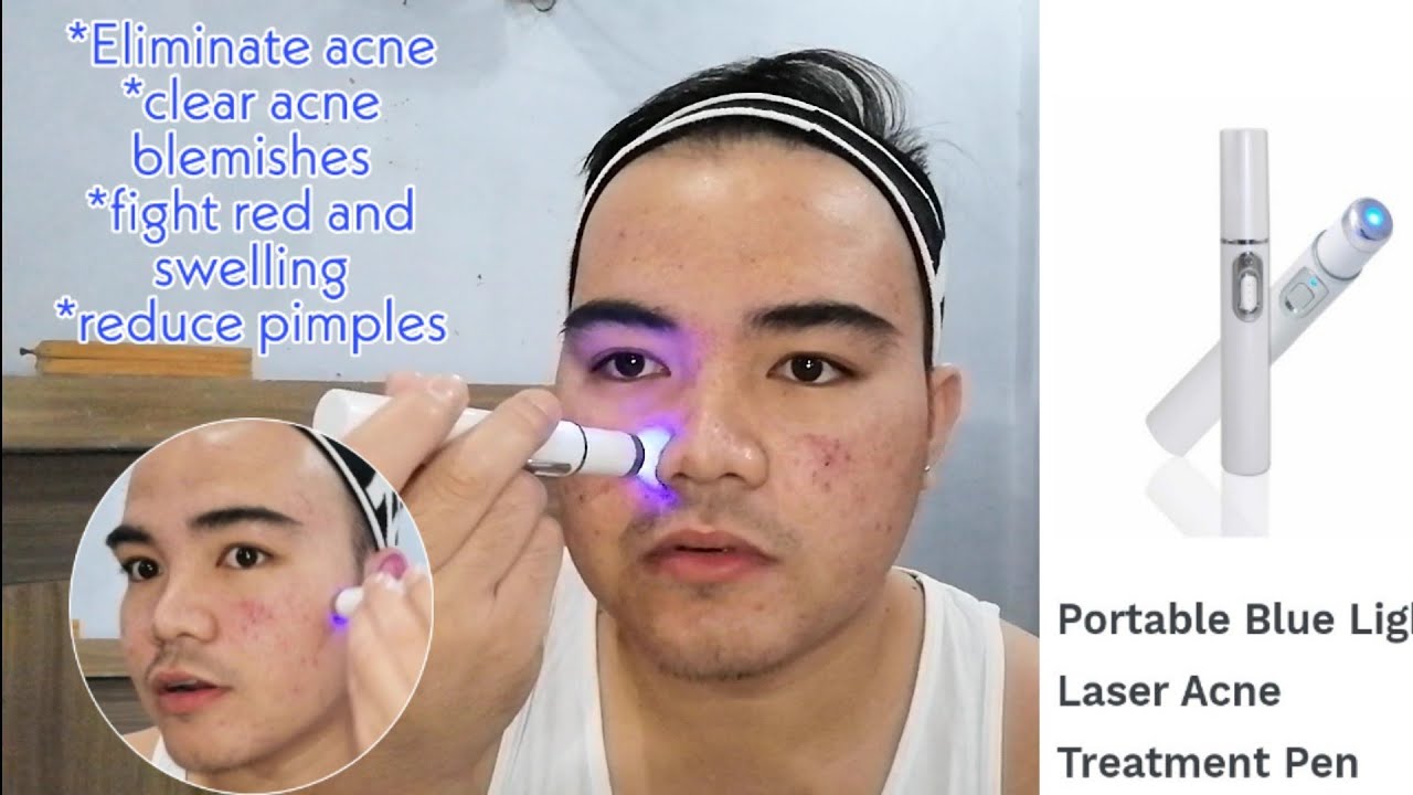 Day1 KD7910 Blue Light ACNE Lacer Treatment Review YouTube