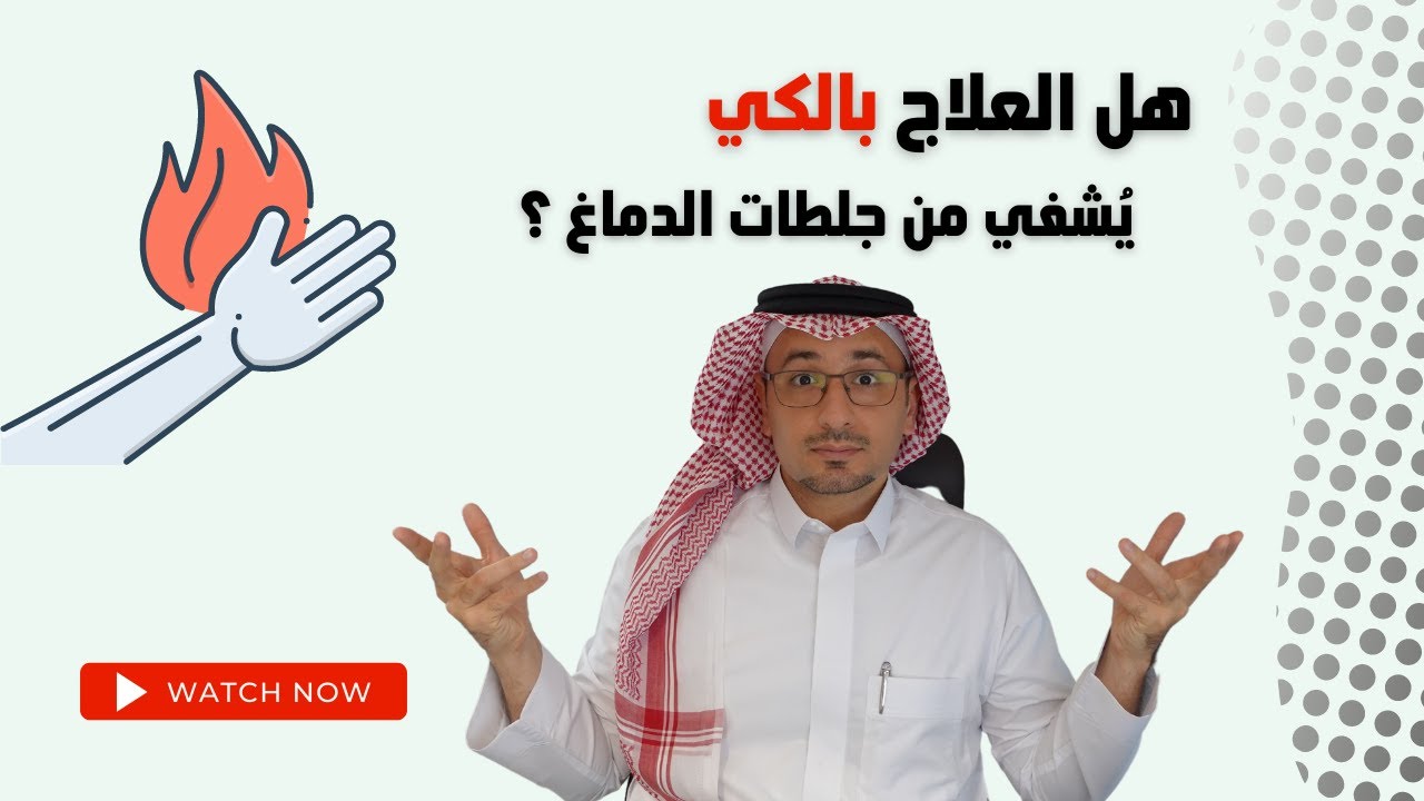 هل الكوي بالنار يشفي من جلطات الدماغ ؟